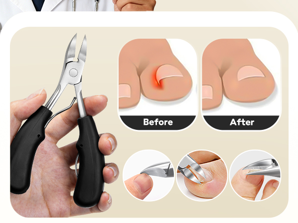 nail clippers toe nail clippers for thick nails for seniors