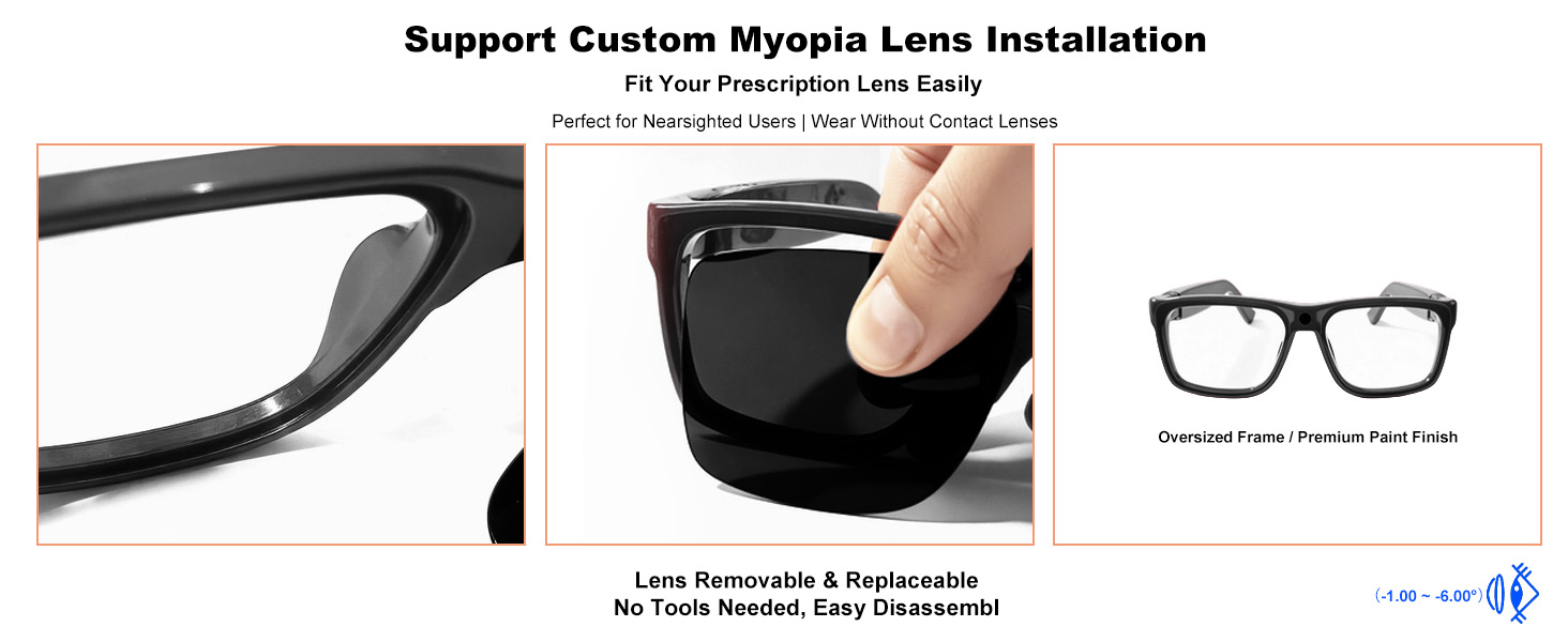 Support Custom Myopia Lens Installation