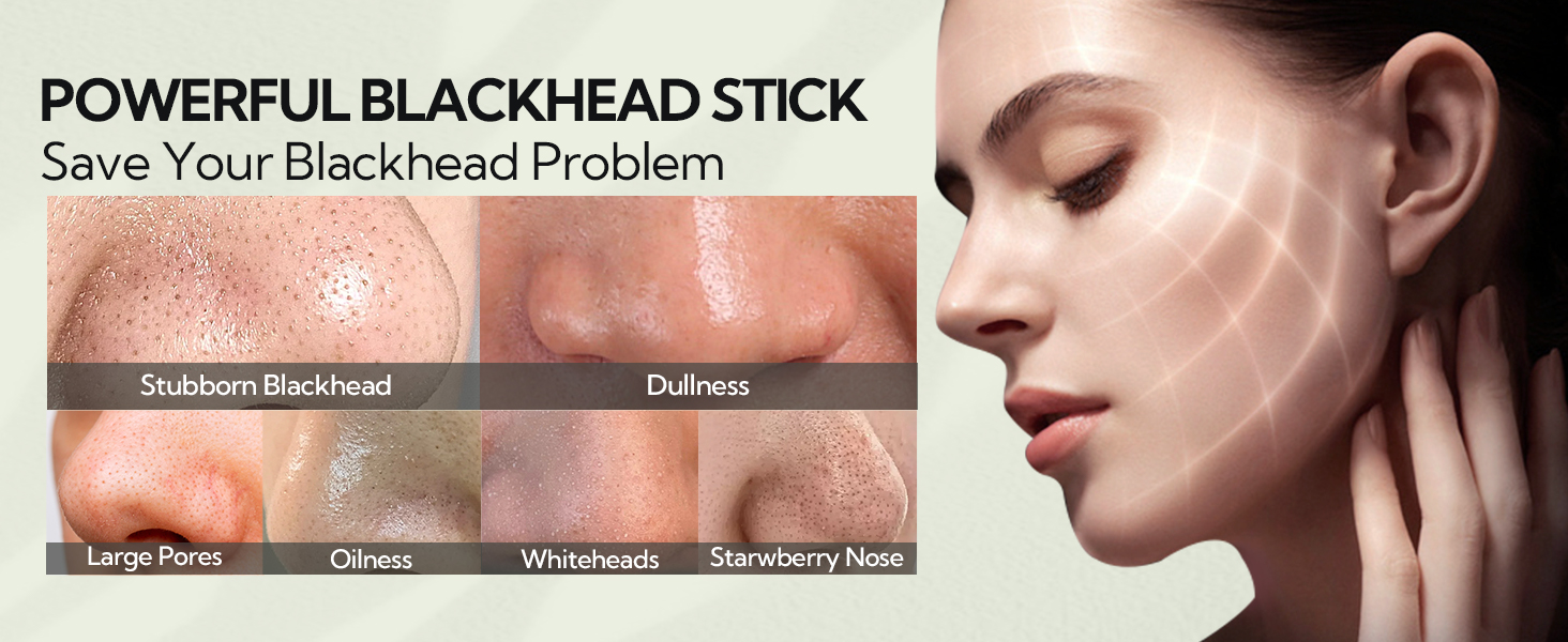blackhead problem