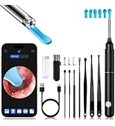 Ear Wax Removal - Ear Cleaner with 1080P HD Camera and 6 LED Lights, Ear Cleaning Kit with 6 Ear ...