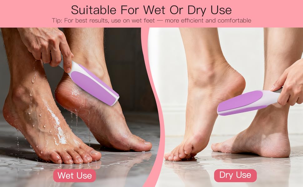 Foot Callus Remover
