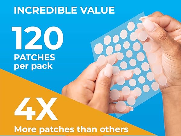 pimple patch, pimple patches, acne patches, pimple patches for face, acne treatment, acne