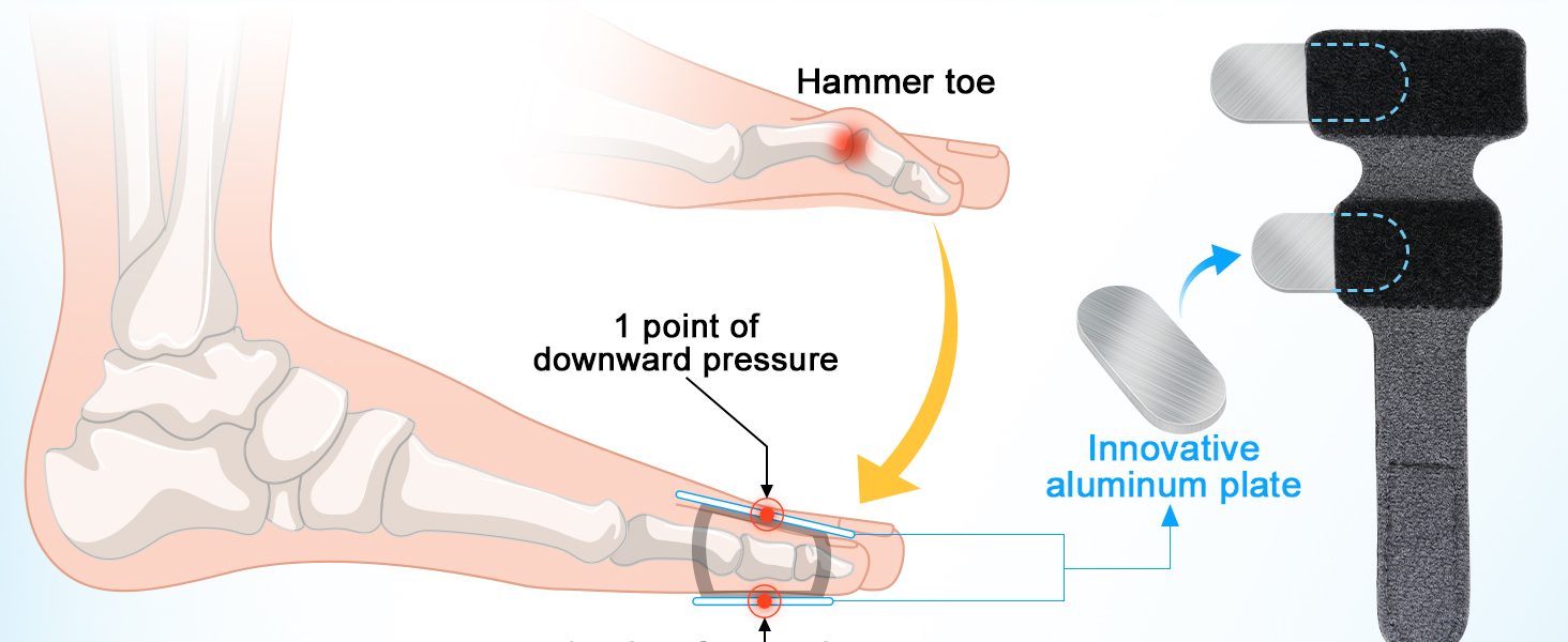 Adjustable Hammer Toe Corrector