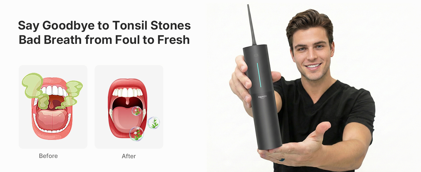 tonsil stone water flosser