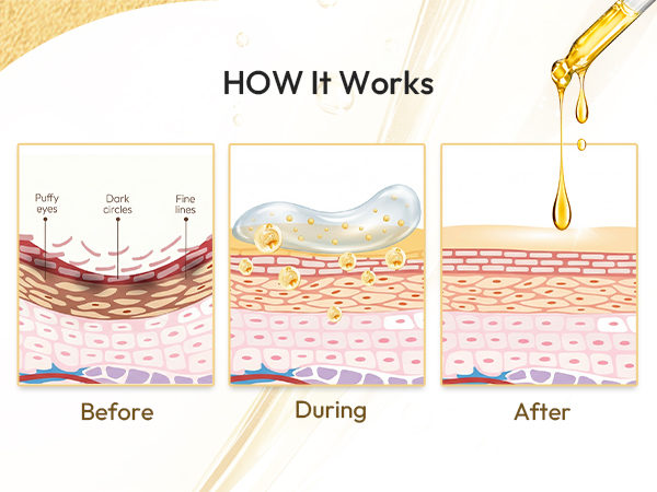 HOW It Works