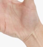 Hand Extensor Exerciser