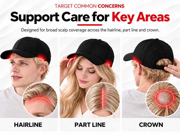 Red Light Therapy for Hair