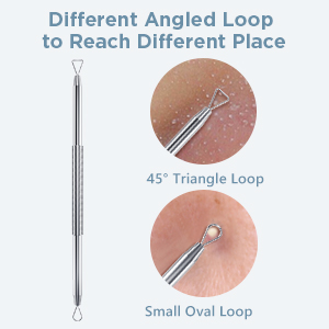 pimple extractor