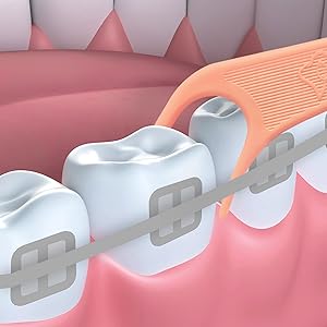 Floss picks for braces