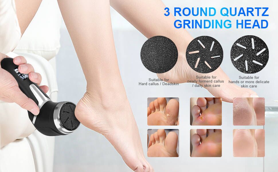 foot callus remover