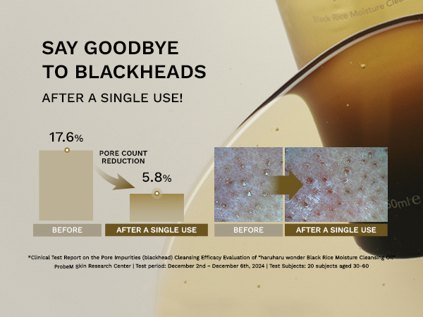 say goodbye to blackheads after single uses