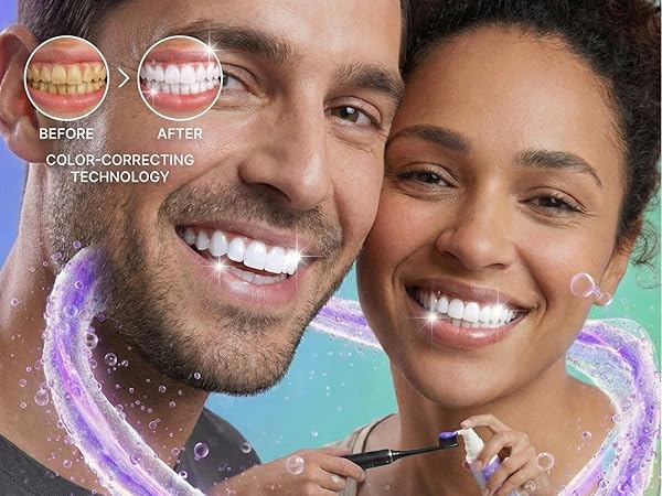 ITZZO Instant Teeth Brightening