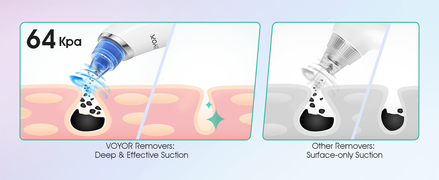 electric blackhead remover pore vacuum