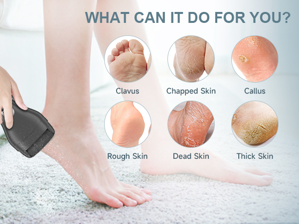 What can it do for you