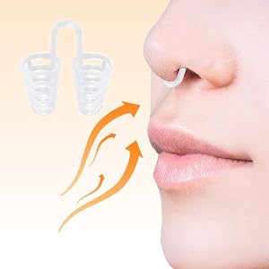 Nose vents