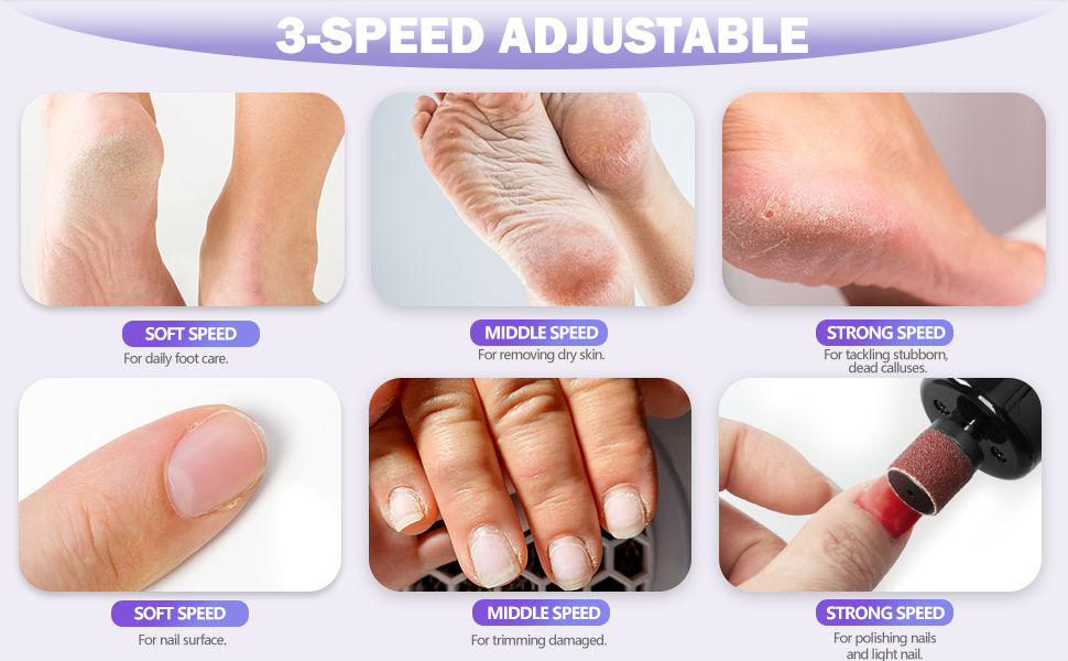 Electric Foot Callus Remover
