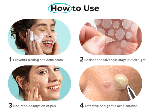 pimple patches