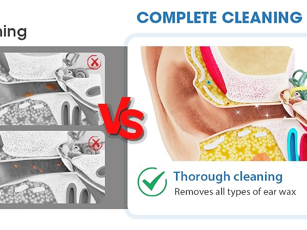 ear cleaner kit with camera