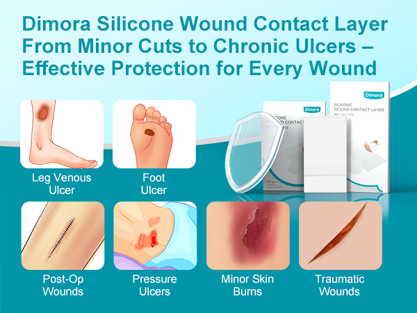 wound dressing
