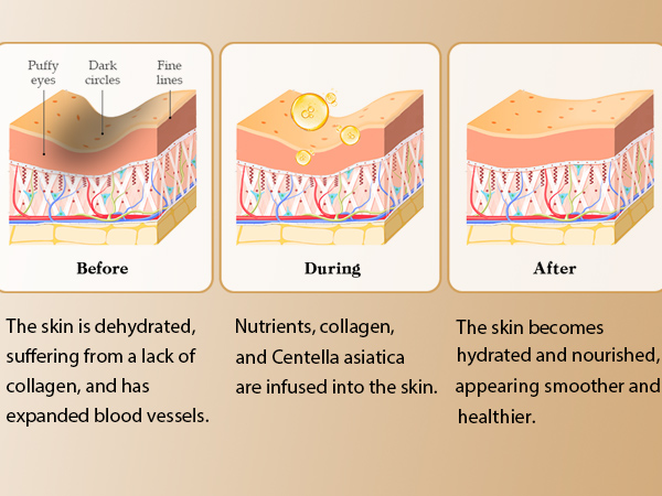 Eye Patches for Puffy Eyes