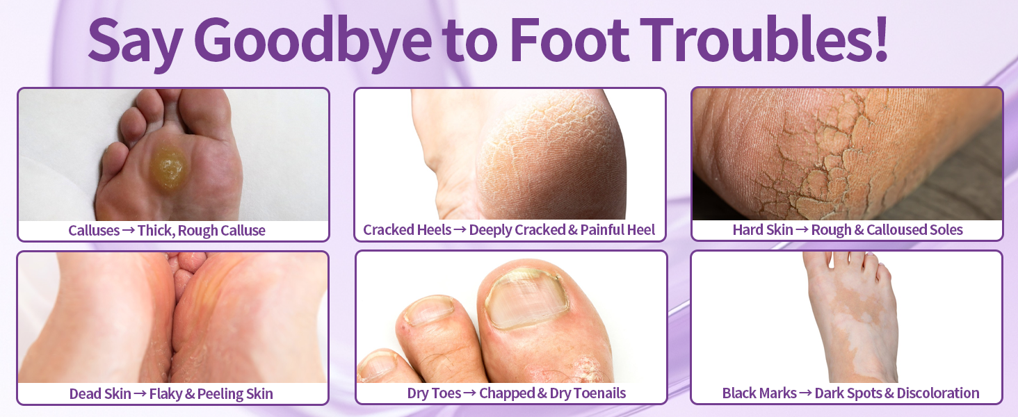 feet mask