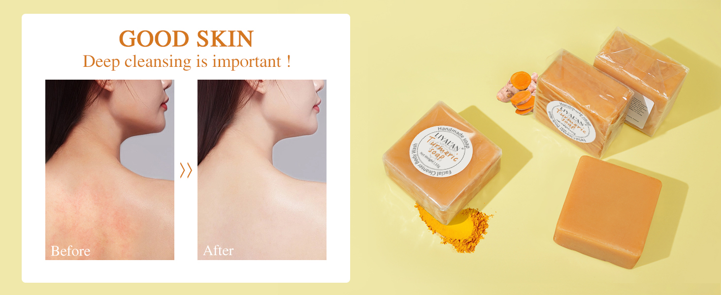 Turmeric soap