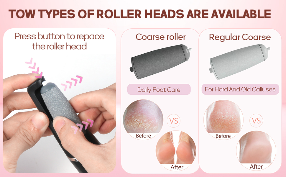 Electric Foot Callus Remover