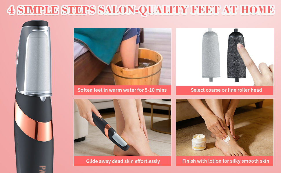 electric callus remover for feet