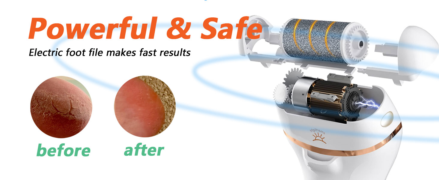 callus remover for feet professional