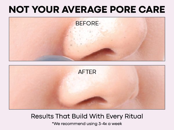 Before and after close-up showing visibly clearer, smoother pores after using Tako Scrub Stick