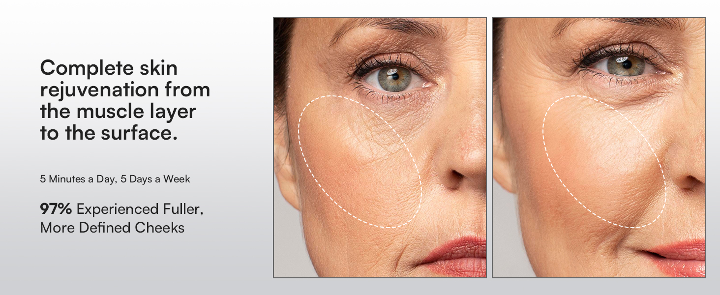 Red Light Therapy for Face