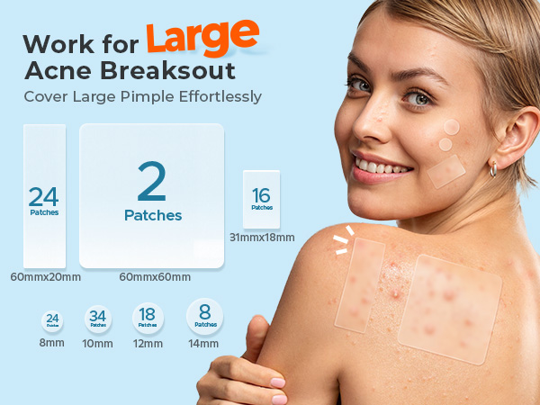 Large Pimple Patches