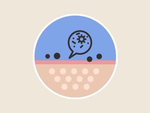 Deep Exfoliation
