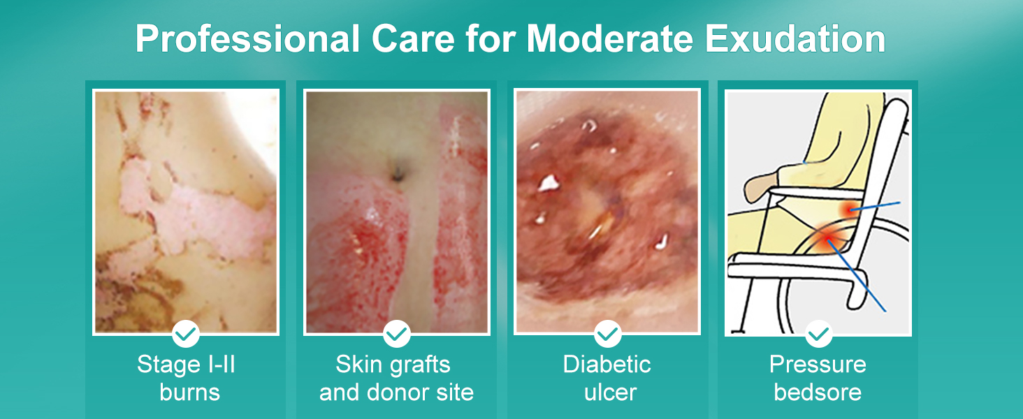 Hydrocolloid Dressing