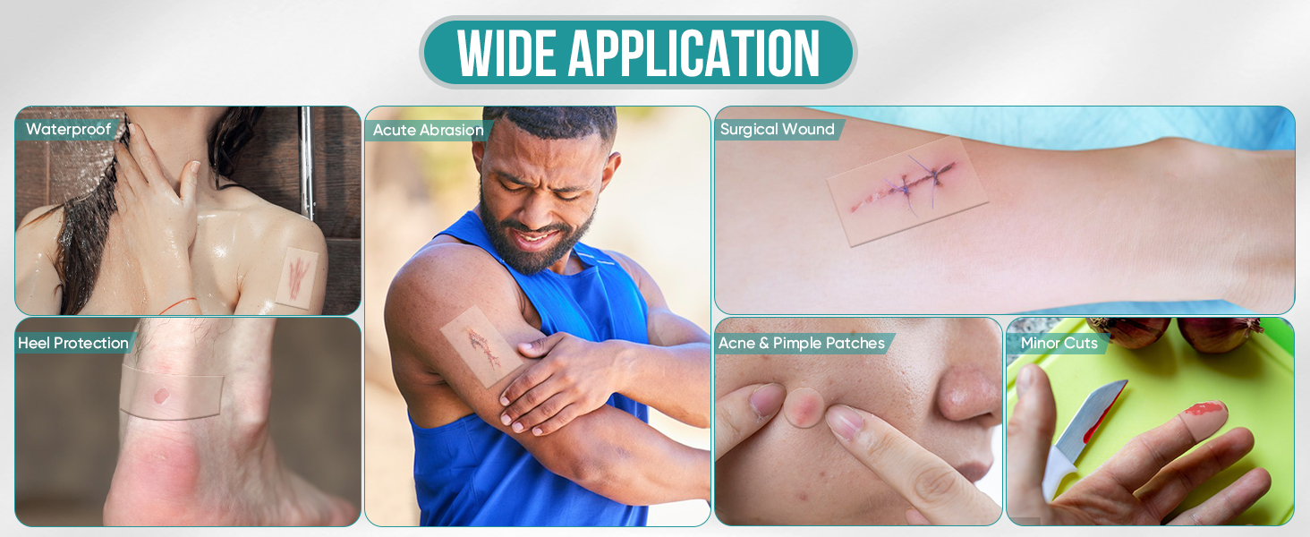 hydrocolloid bandages