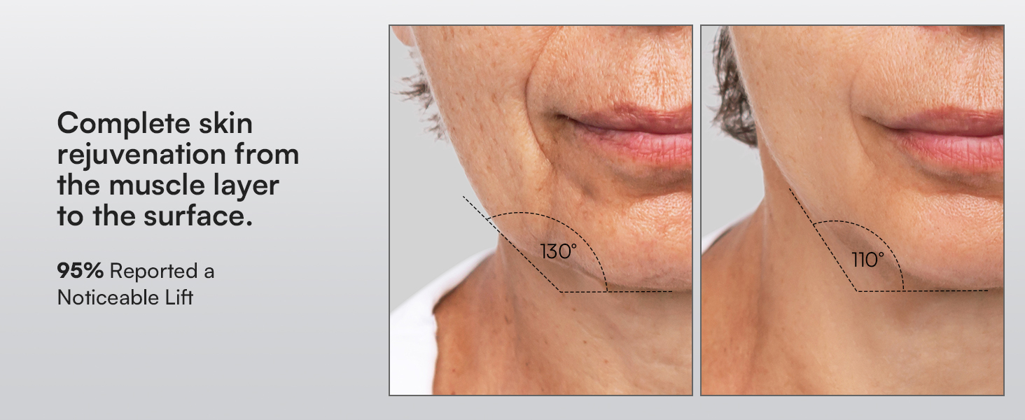 Red Light Therapy for Face