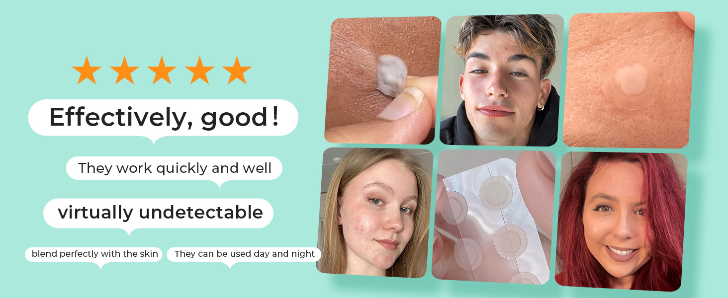 Invisible Pimple Patches