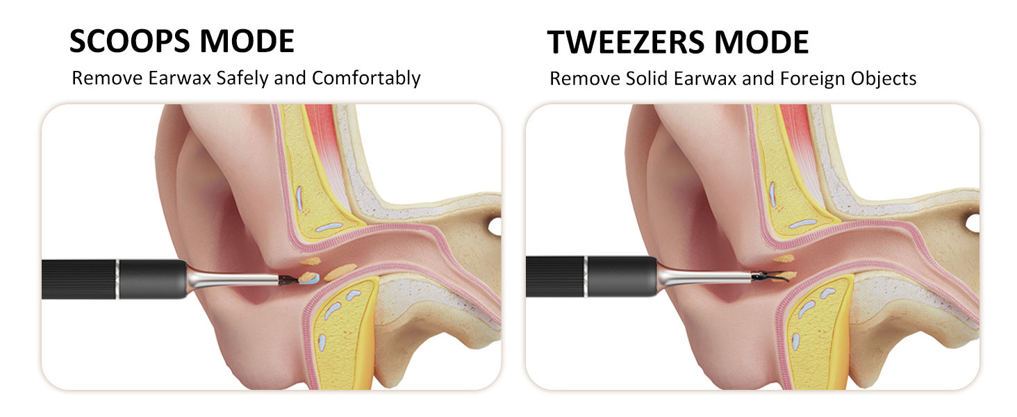 Ear Wax Removal Tool