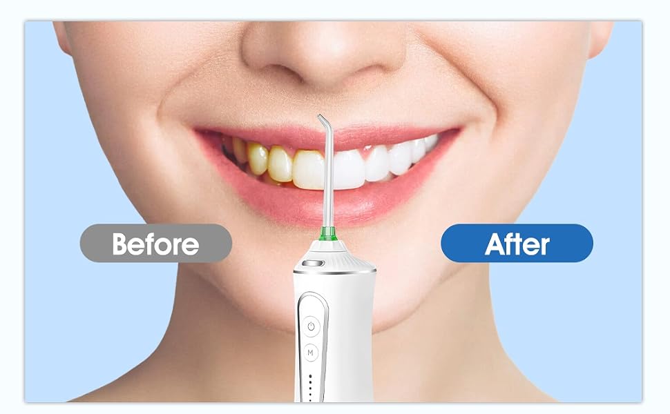 DENTAL FLOSSER