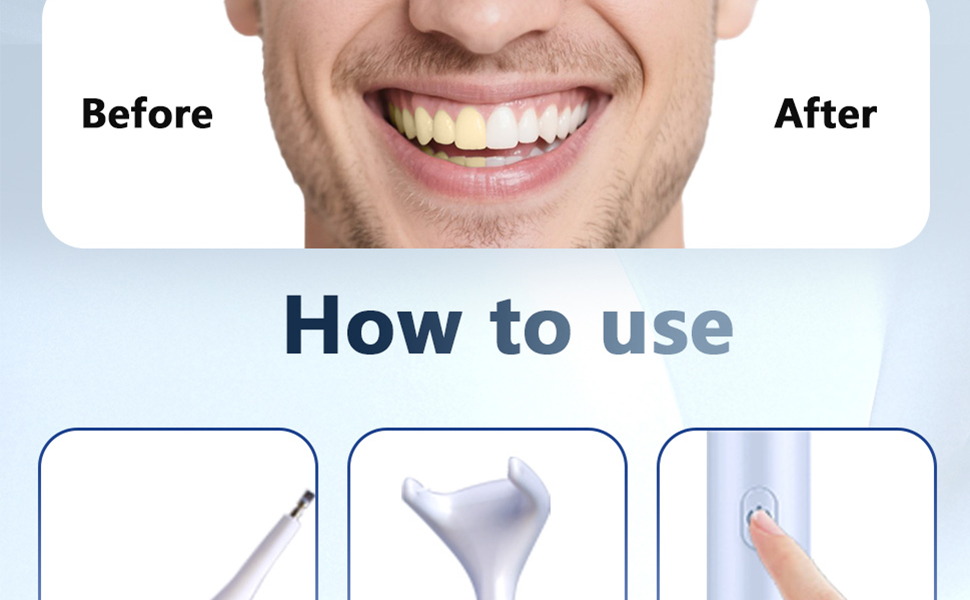 goflaus electric flosser