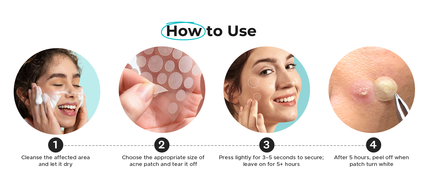 pimple patches