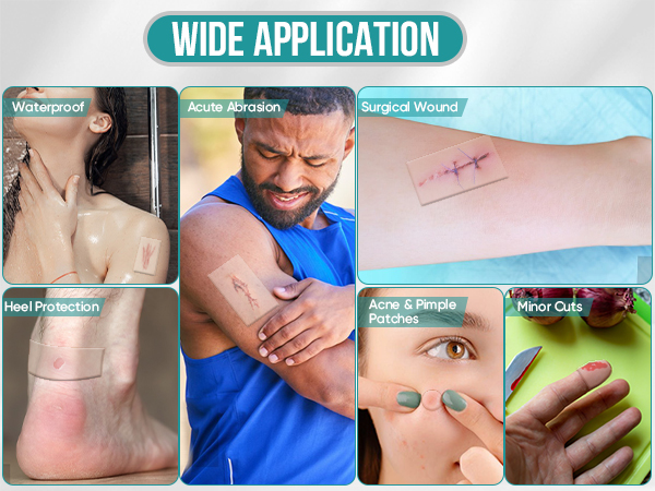 hydrocolloid bandages