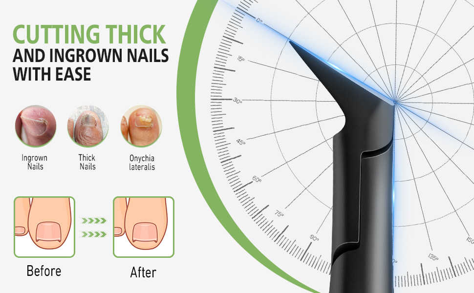 toenail clipper for ingrown nails straight toenail clipper ingrown toenail clippers for seniors