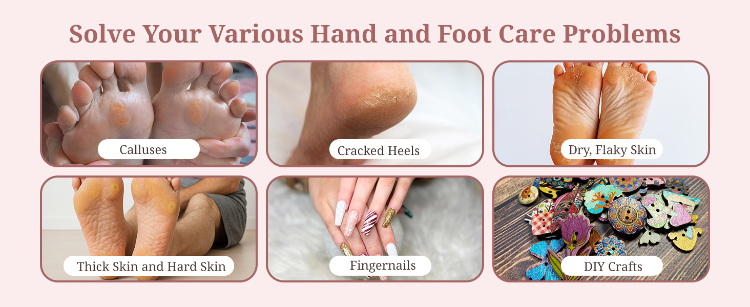 Electric Foot Callus Remover