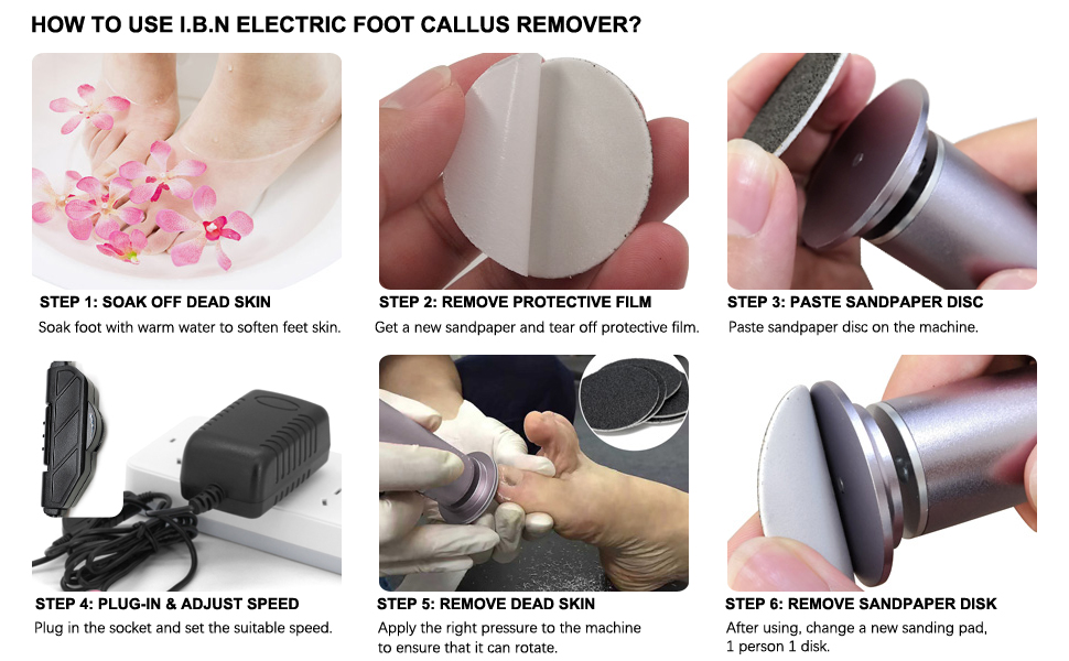 electric foot callus remover