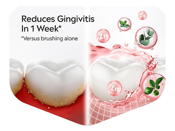 reduces gingivitis in 1 week