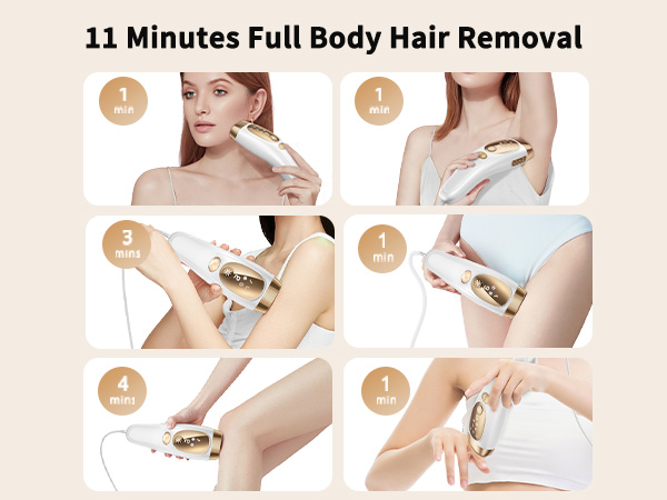 laser hair removal