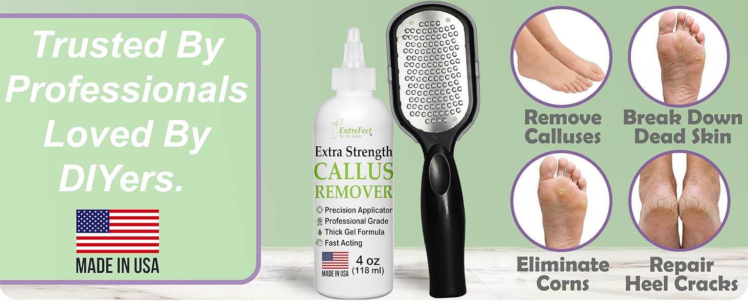 foot callus remover