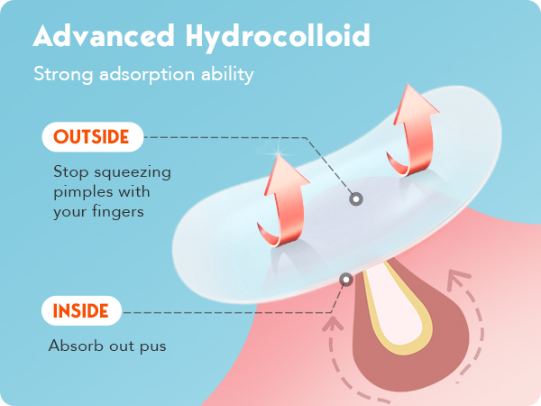 hydrocolloid