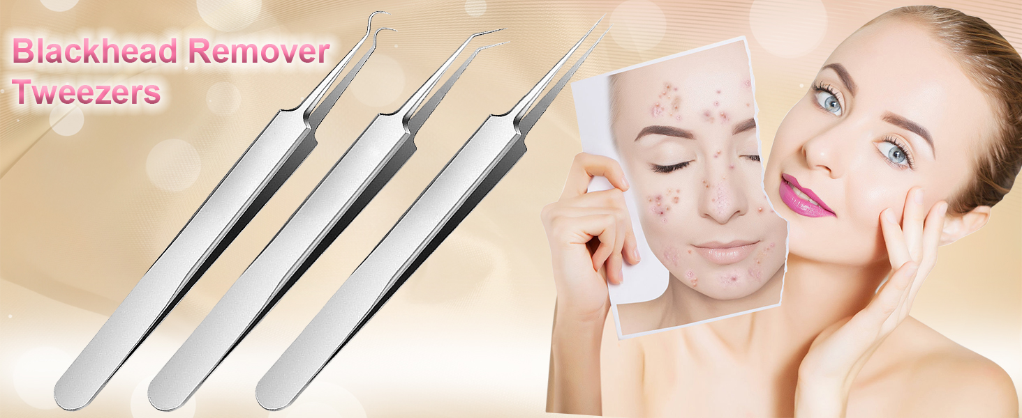 Blackhead tweezers